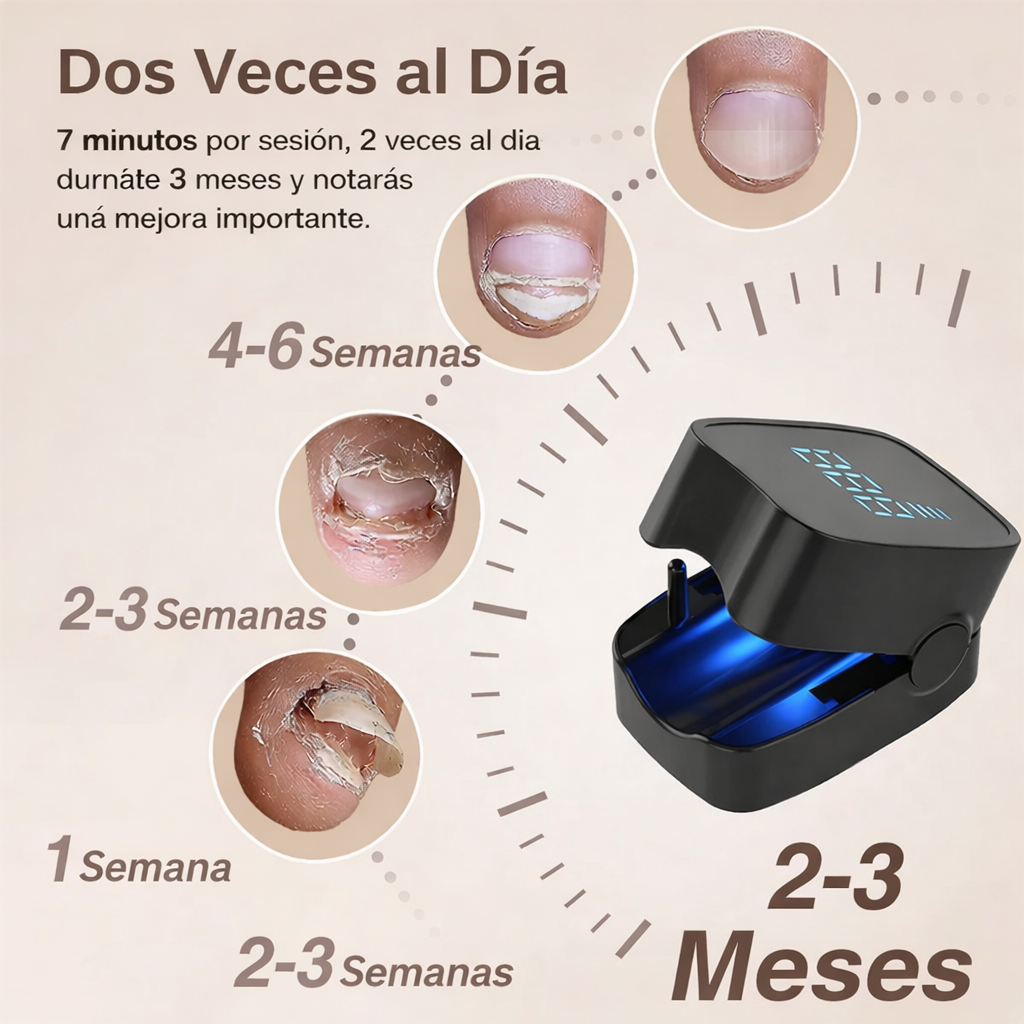 Láser Antihongos para Uñas (Uso Doméstico)